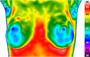 Infrarotthermographie einer gesunden Brust vor Abkühlung